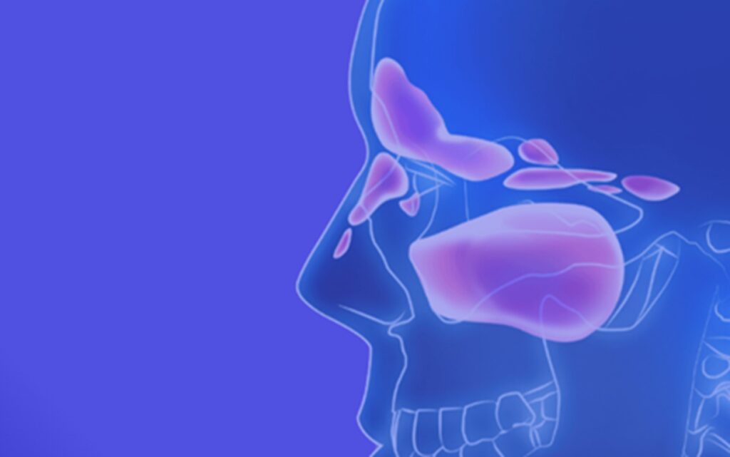 Sinus Track